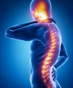 The Costs of Spinal Cord Injuries